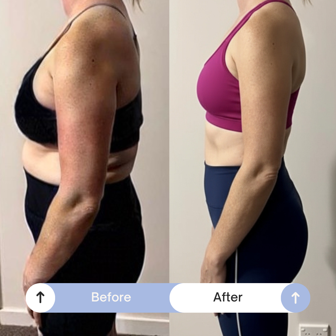 Kelly transformation