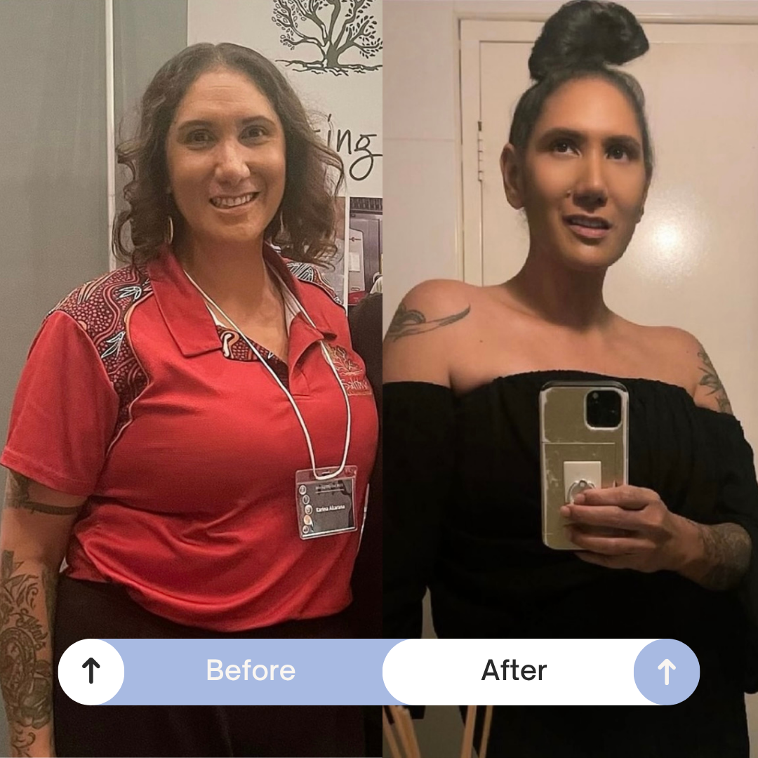 Karina transformation